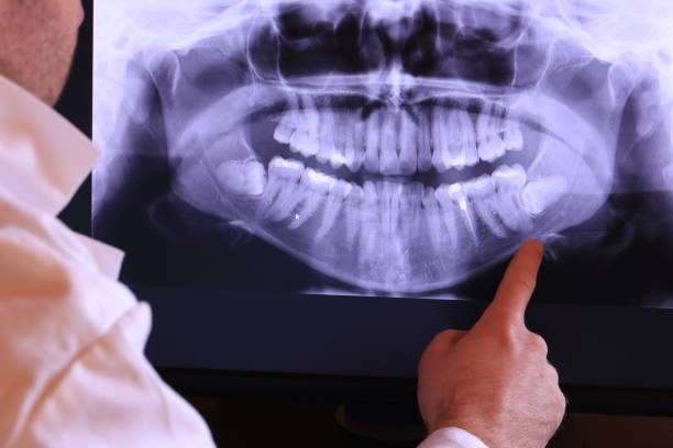 Best Broken or Cracked Tooth Emergency Dentist in Elizabeth, NJ