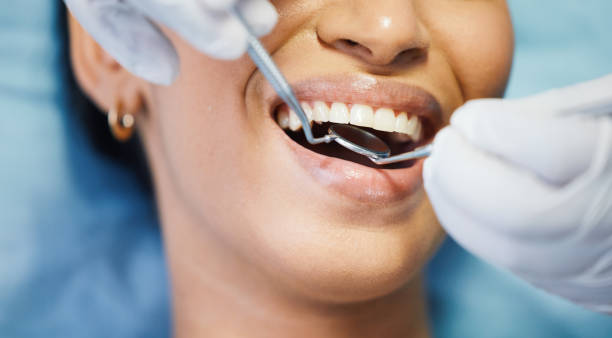 Best Emergency Dentist for Lost Fillings or Crowns in Elizabeth, NJ